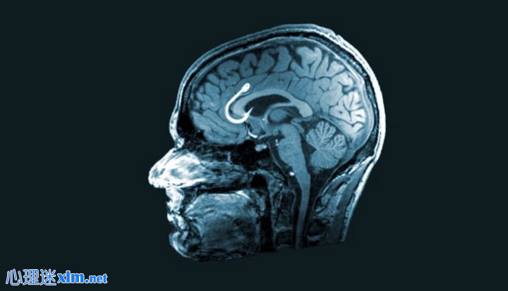 聪明人破坏成功的5种方式