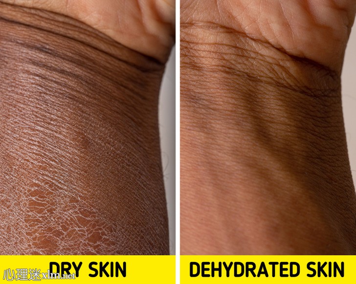 6个小贴士可以让你的皮肤保持水分和年轻
