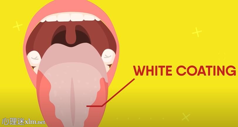 你的舌头可能很脏，以下是有效清洁它的方法