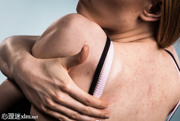 8个身体部位的粉刺试图告诉你你的生活习惯