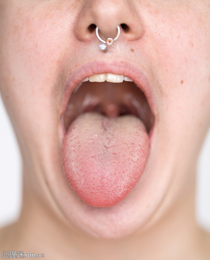 什么是“白舌头”，该怎么做？