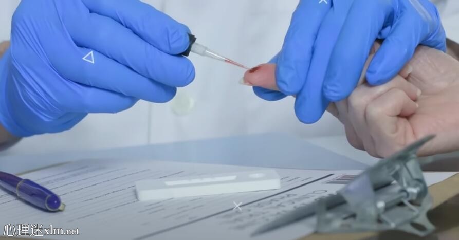 甲状腺功能减退和甲状腺功能亢进的区别是什么?