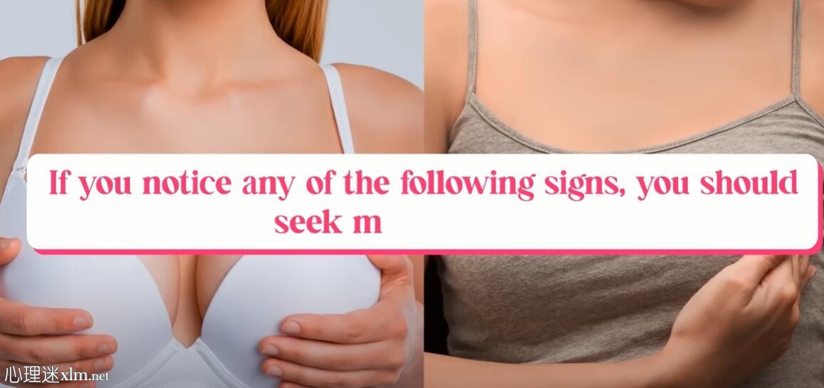 女性需要知道乳腺癌的早期预警信号!